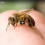 Advice on how to treat a Bee sting.